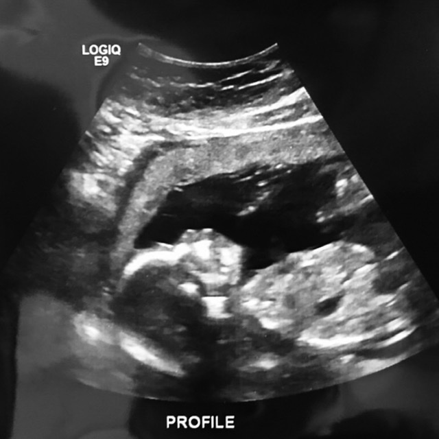 Sometimes you can't just 'Decide' to become a parent